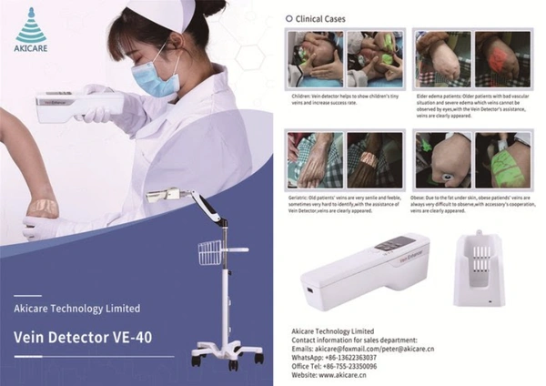 Hand Held Vein Detector